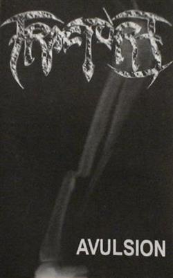 Download Fracture - Avulsion